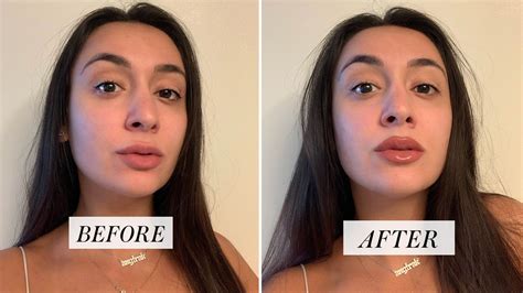 Mastering Lip Line Magic: Tips for a Picture-Perfect Smile